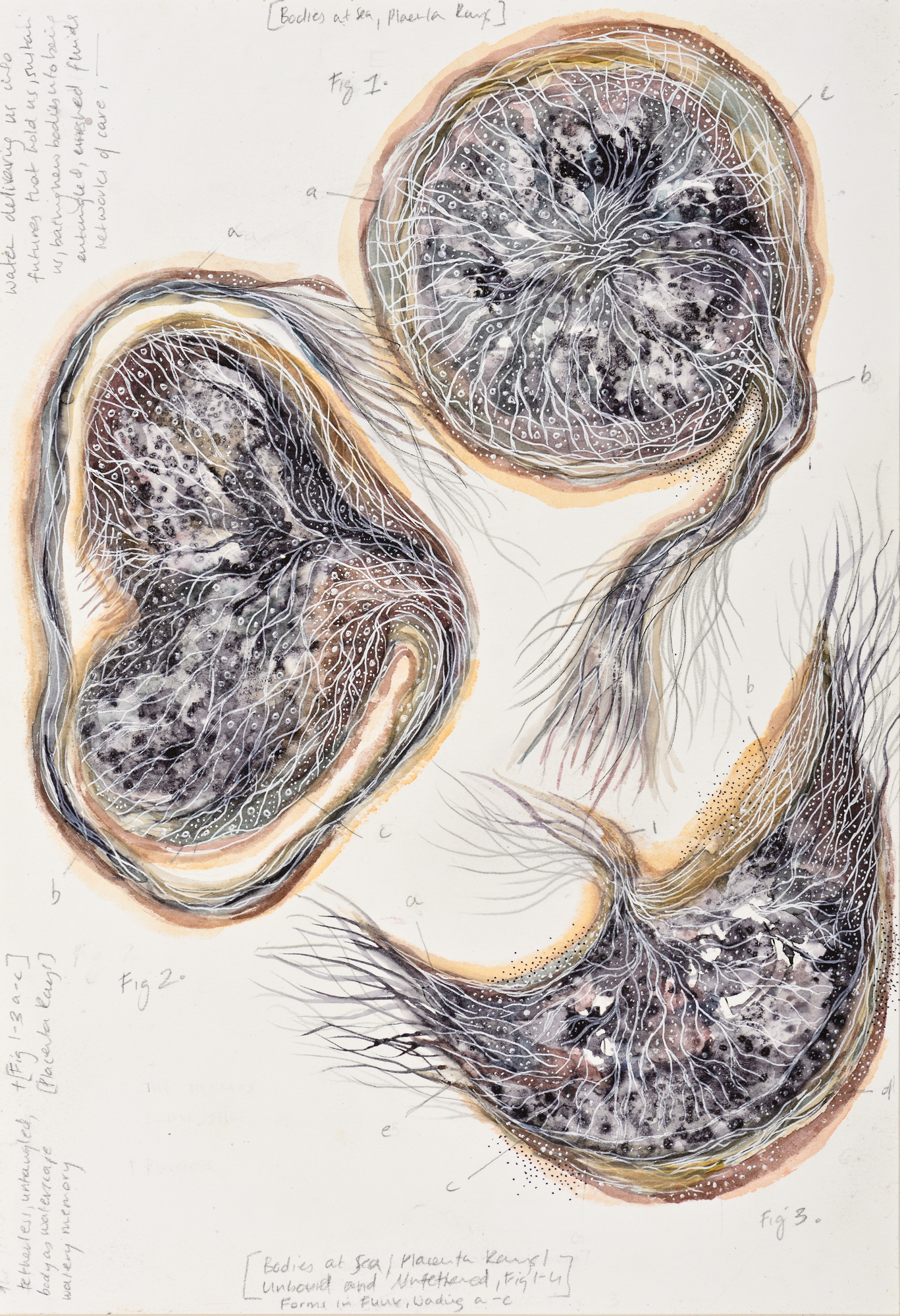 Devika Sundar, art and health, contemporary Indian Artist