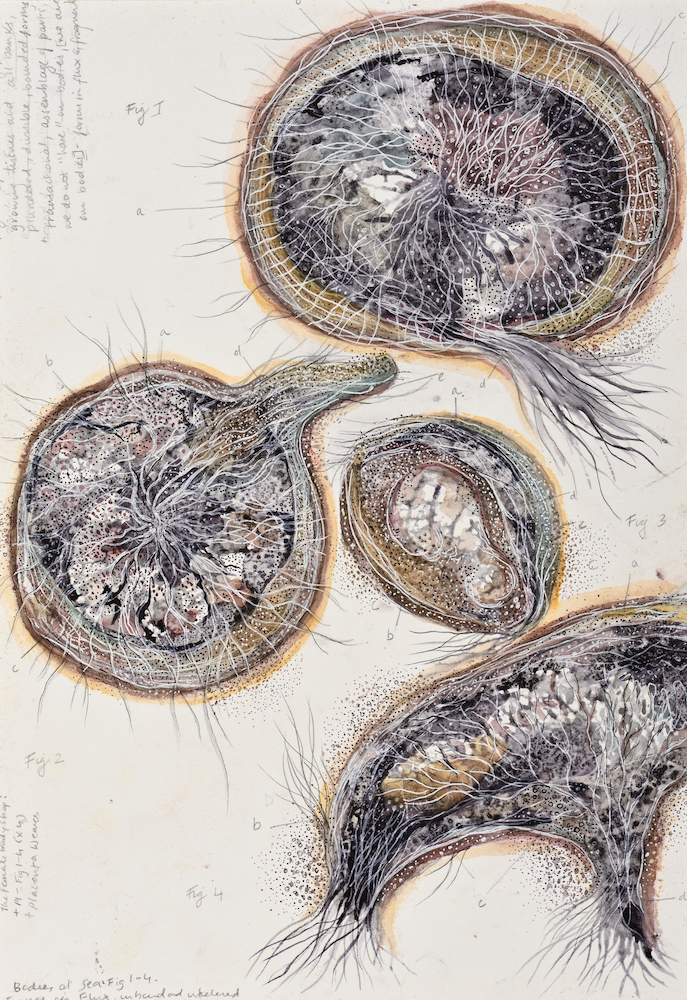 Devika Sundar, art and health, contemporary Indian Artist