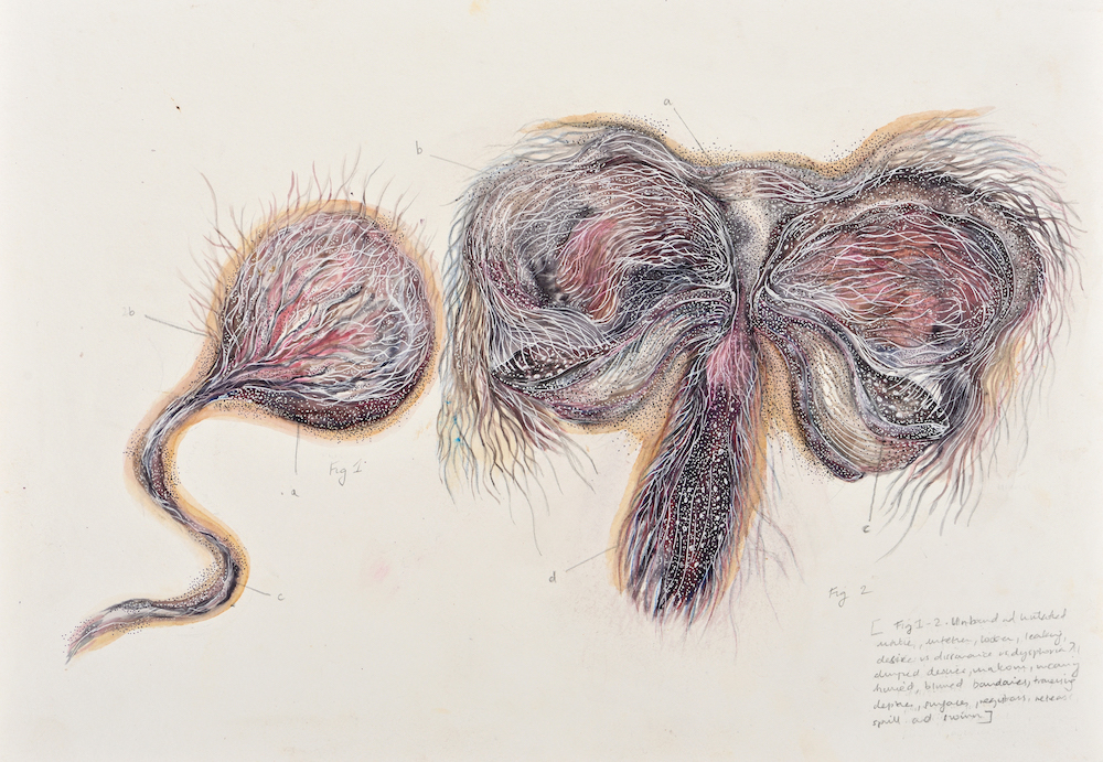 Devika Sundar, art and health, contemporary Indian Artist