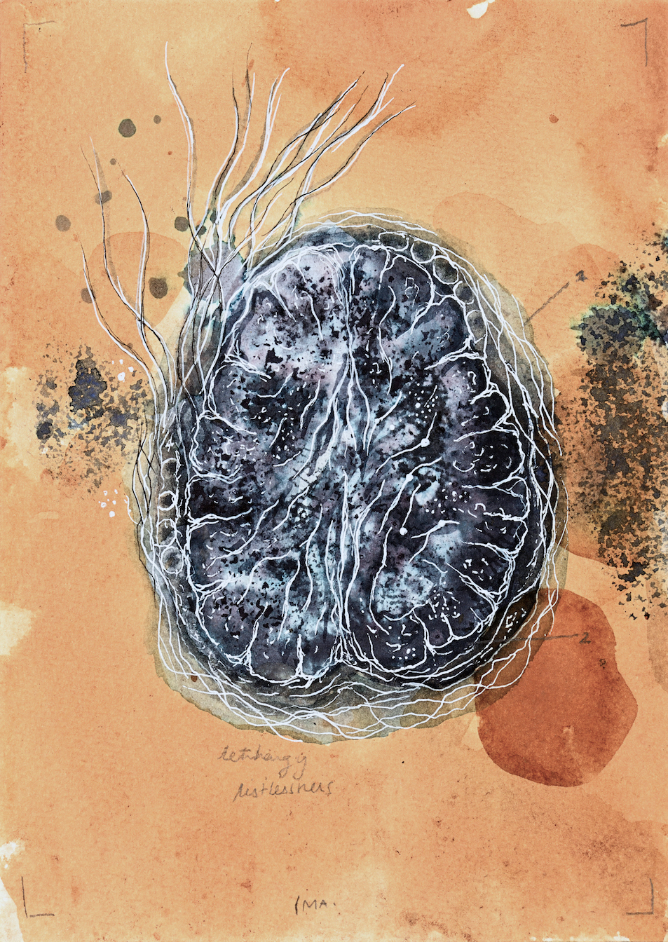 Devika Sundar, art and health, contemporary Indian Artist
