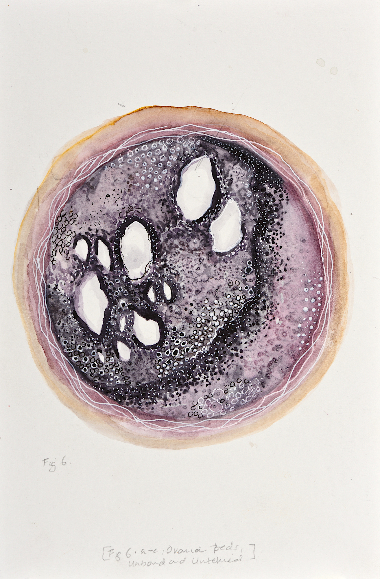 Devika Sundar, art and health, contemporary Indian Artist
