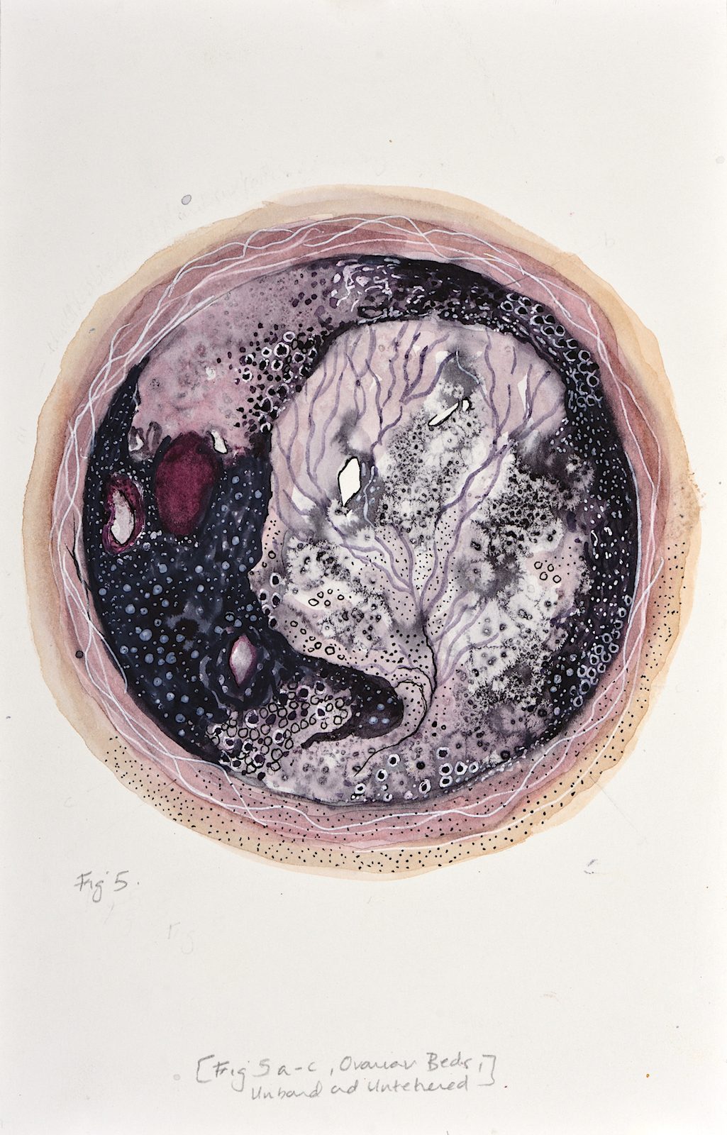 Devika Sundar, art and health, contemporary Indian Artist